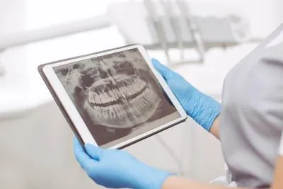 dental x-ray technology used at Park View Dental in Eldridge, IA